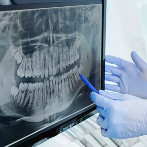 1 visita e panoramica rx a scopo diagnostico in omaggio